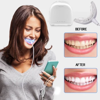 Портативное устройство для отбеливания зубов с умным холодным синим светом 3 в 1, коробка для устройства Smart LED для отбеливания зубов, Портативная USB-зарядка оптом